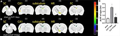 Disrupted metabolic and spontaneous neuronal activity of hippocampus in sepsis associated encephalopathy rats: A study combining magnetic resonance spectroscopy and resting-state functional magnetic resonance imaging